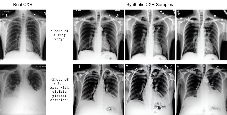 Radiologie réel et synthétique